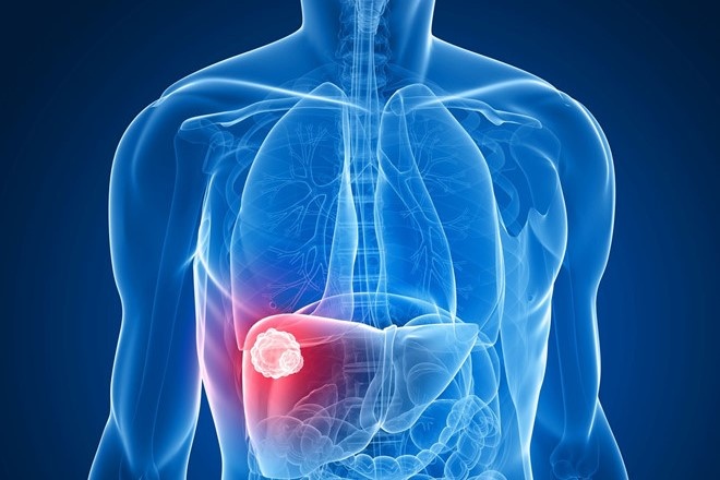 Nam gioi co nguy co cao mac loai ung thu nao? hinh anh