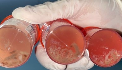 Ho va kho tho suot 1 thang, nguoi phu nu bat ngo khi biet ly do hinh anh