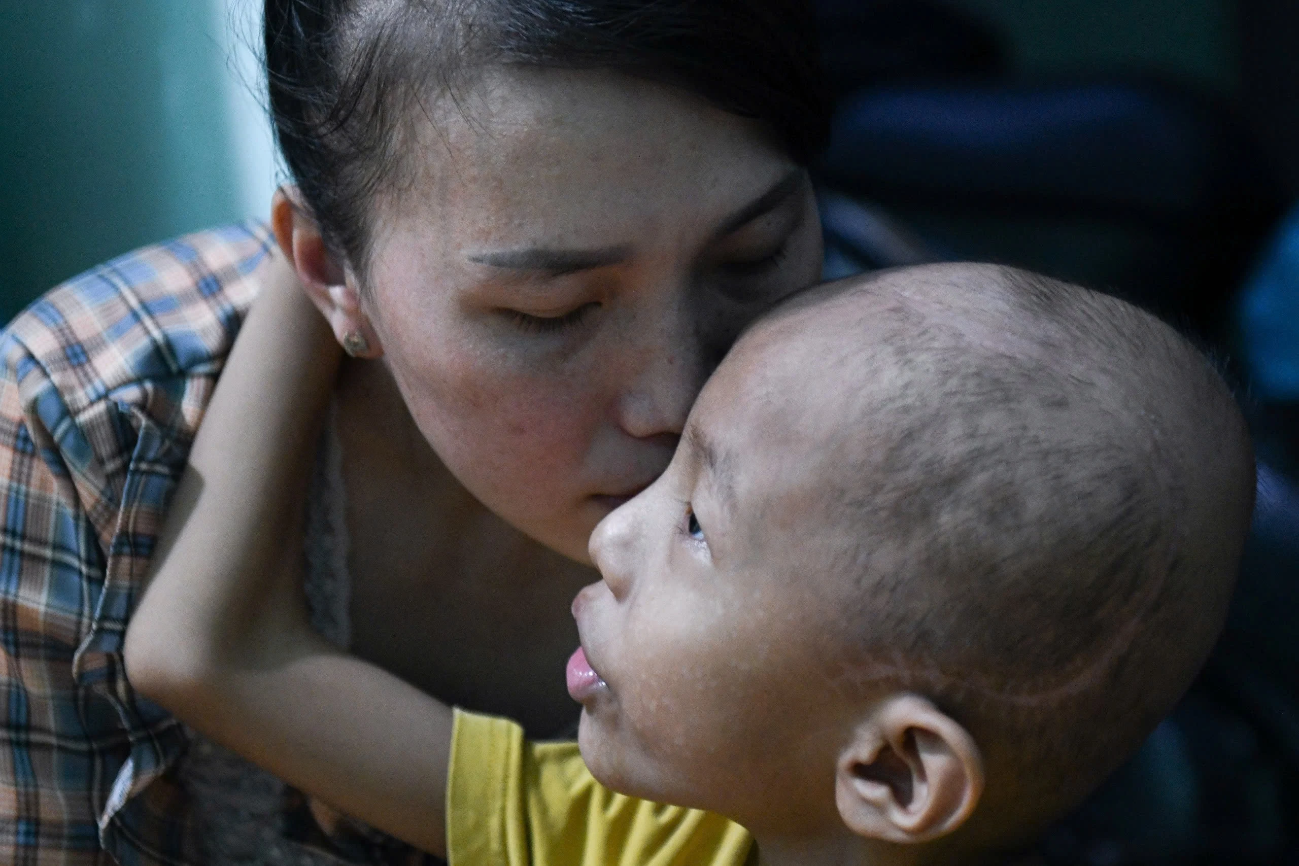 Muon giup tre benh nang, hay den khoa ung buou, ICU hinh anh