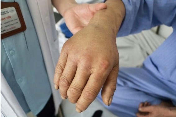 Tin loi 'than y', nguoi dan ong nhap vien trong dau don hinh anh