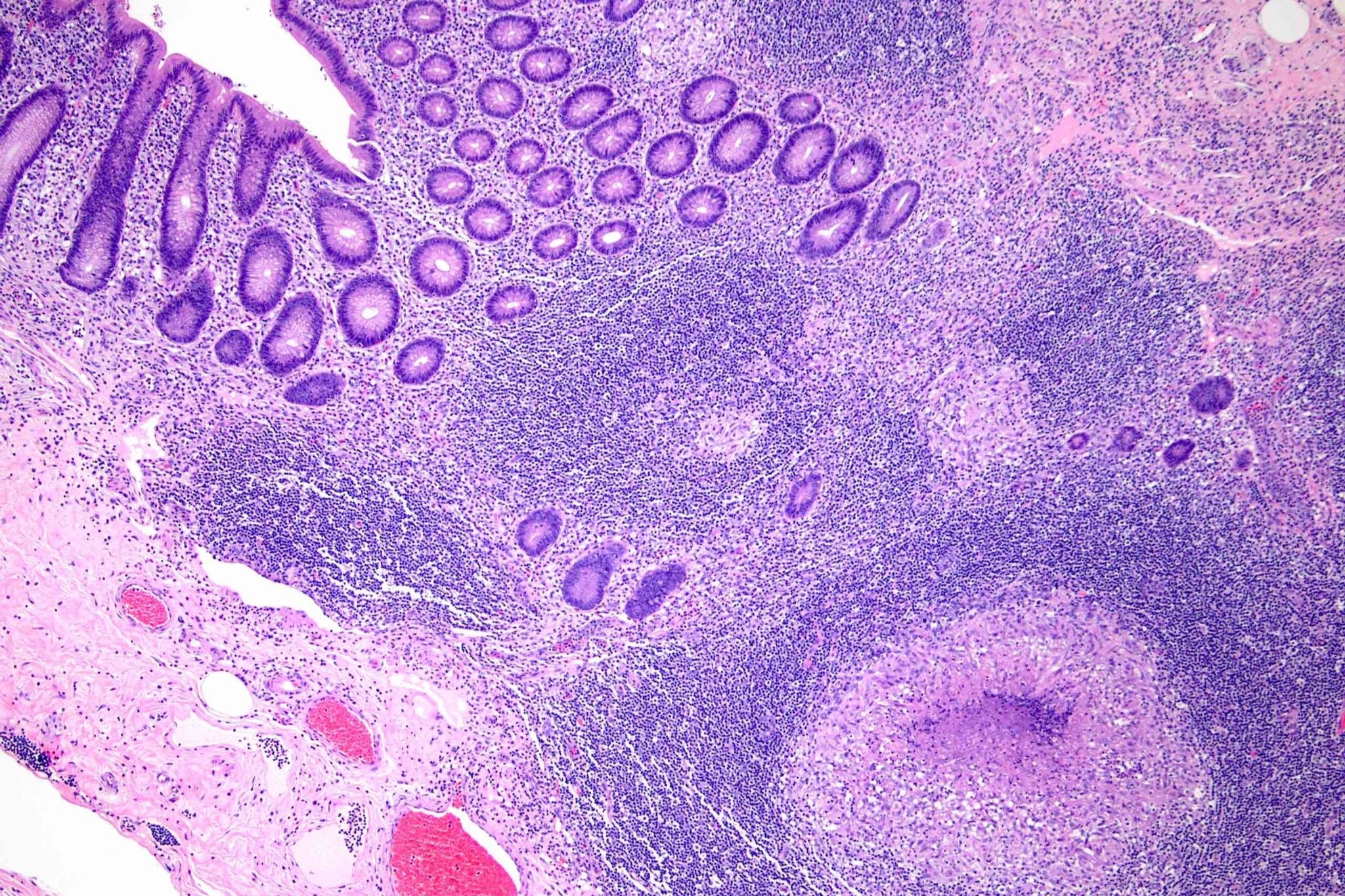 Nguoi dan ong dau ruot thua vi mot ly do khong ai ngo hinh anh