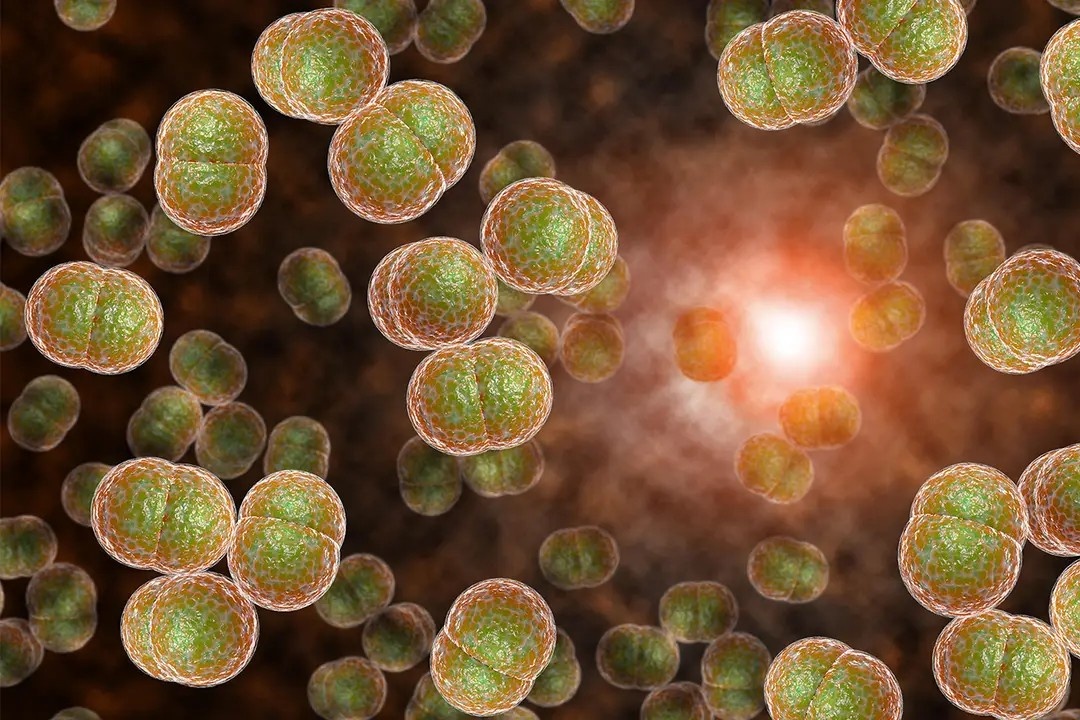 Ly do viem mang nao do nao mo cau la 'benh tu 24 gio' hinh anh