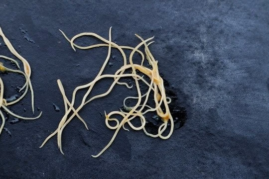 Vi sao tay nhieu lan van khong het giun kim? hinh anh