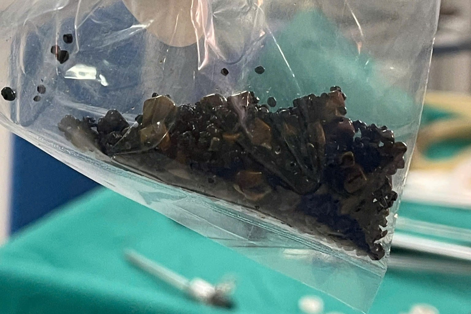 Hang tram vien soi trong tui mat nguoi phu nu hinh anh