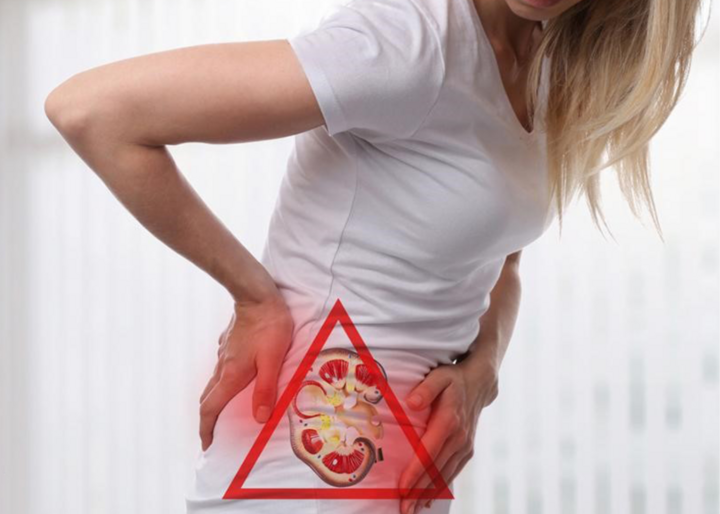 Benh suy than co nguy hiem? hinh anh