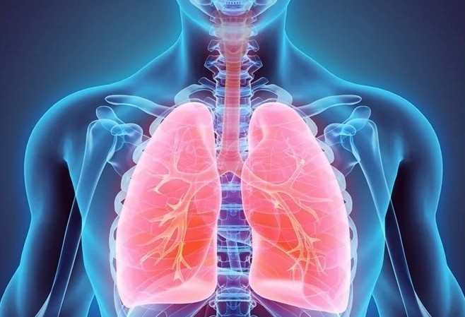 COPD anh 1