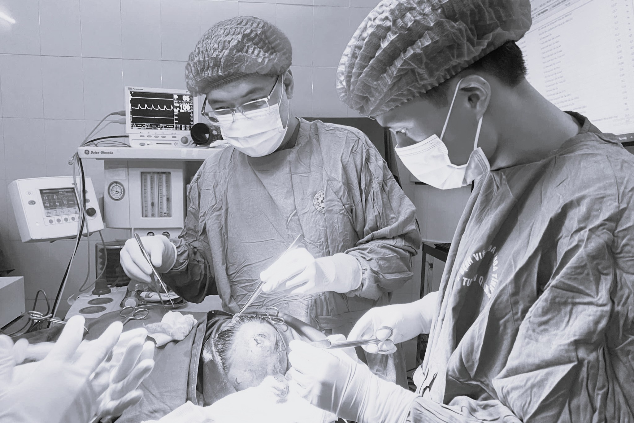 Be 4 tuoi nhap vien voi vung dau thung sau do bi cho nha can hinh anh