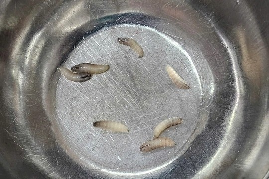 Rung minh phat hien o gioi 7 con lam to trong mui benh nhan hinh anh