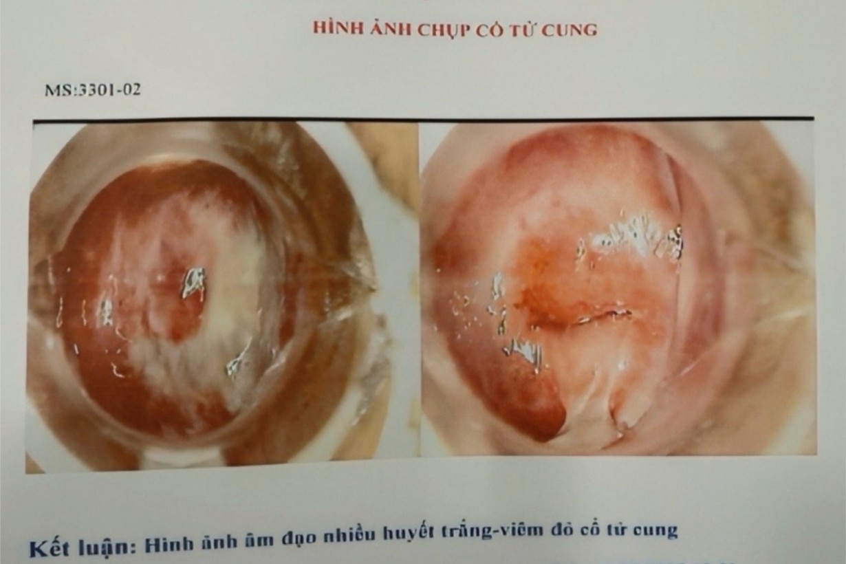 phong kham ve benh anh 1