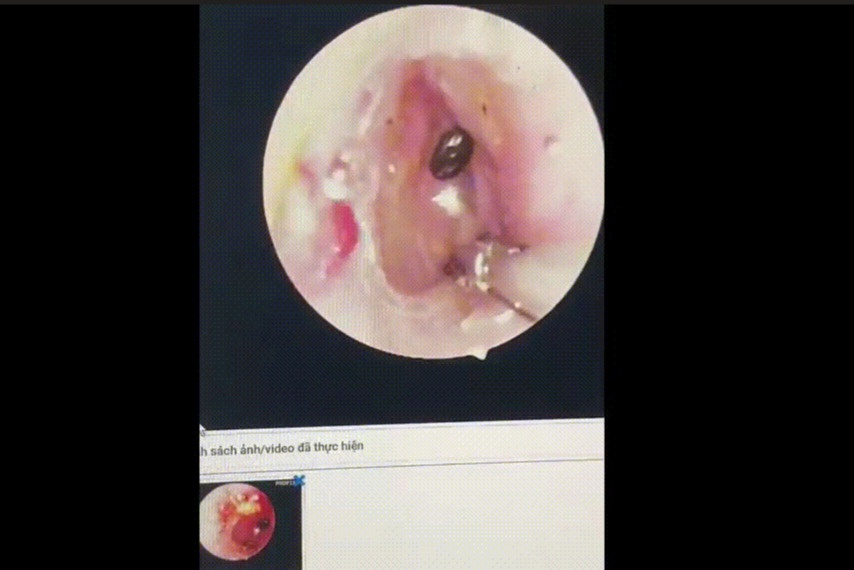 Bo chet cho lam to trong tai be 9 tuoi hinh anh