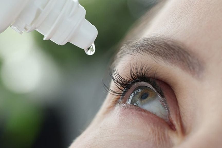 Mo, kho va moi mat, nen chon thuoc nho mat nhu the nao? hinh anh