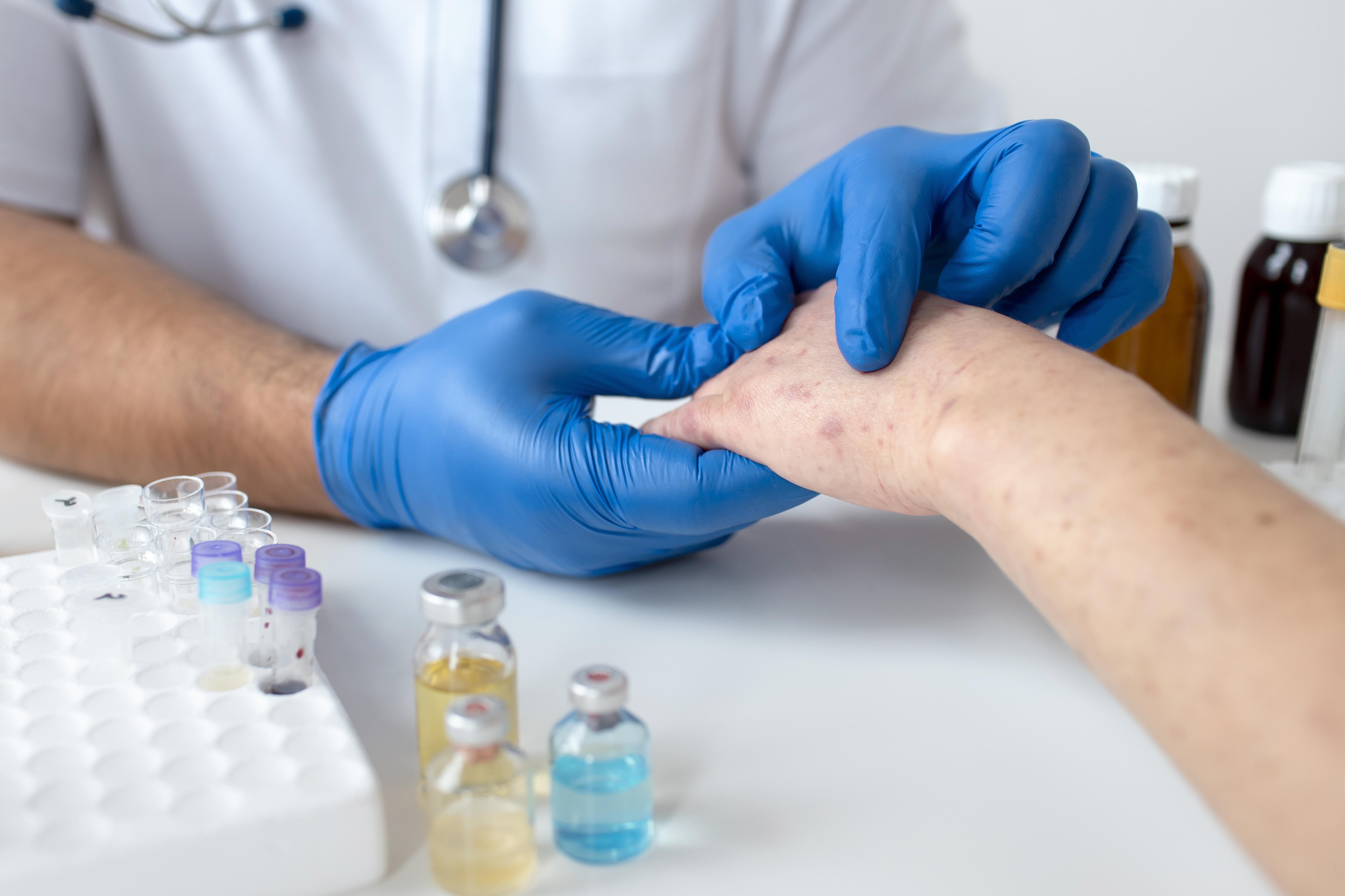 Vi sao co nguoi mac thuy dau hai lan? hinh anh