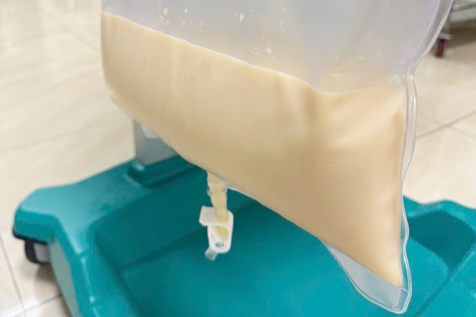 Huyet tuong trang nhu sua vi thoi quen dan ong Viet thuong lam hinh anh