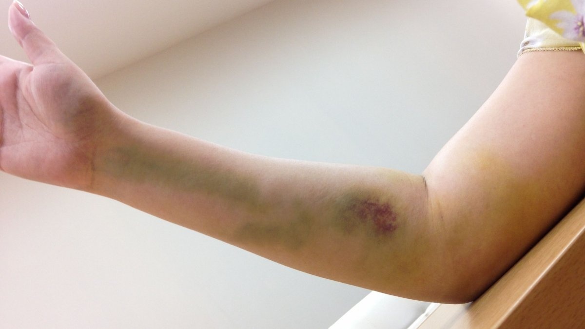 Mot phong benh co 3 cap vo chong cung dieu tri ung thu hinh anh