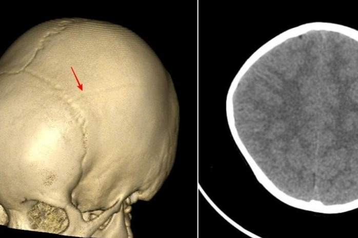 Cha me hoi han vi cu nga tuong chung vo hai cua con hinh anh