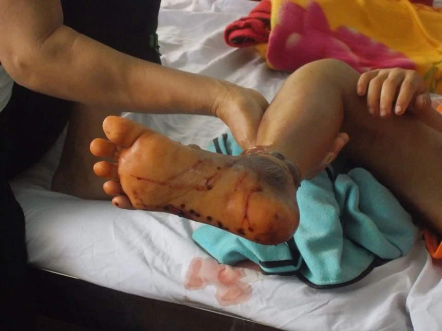 ran luc duoi do anh 4