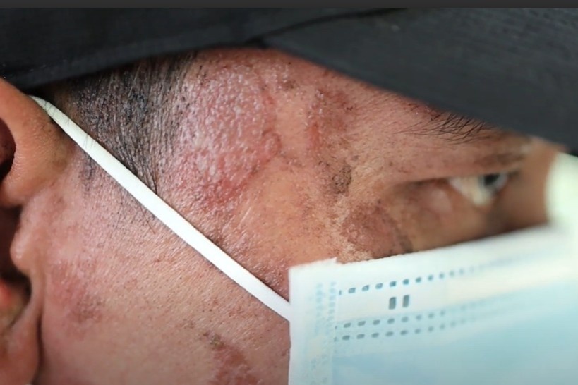 Nguoi dan TP.HCM kho so vi kien ba khoang hinh anh