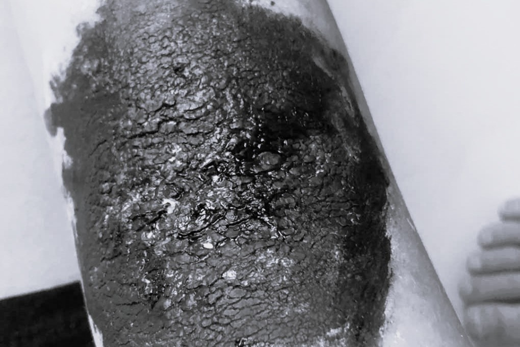 kien ba khoang anh 4