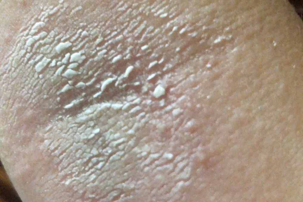 kien ba khoang anh 1