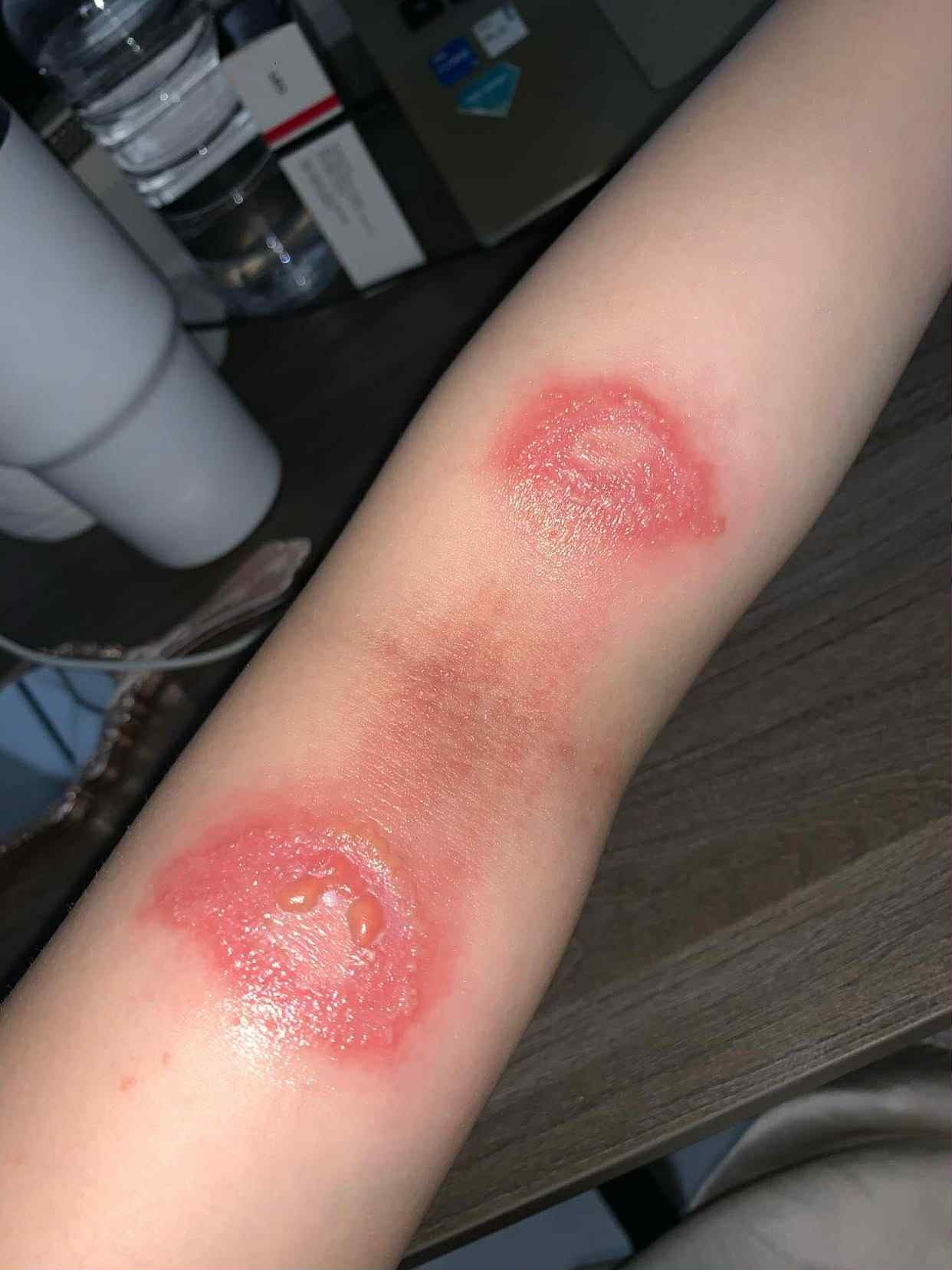 kien ba khoang anh 7