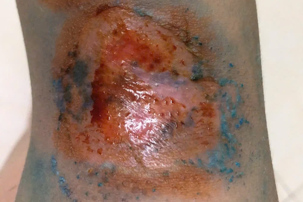 kien ba khoang anh 5