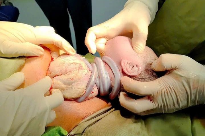 Em be chao doi voi 6 vong day ron quan quanh co hinh anh