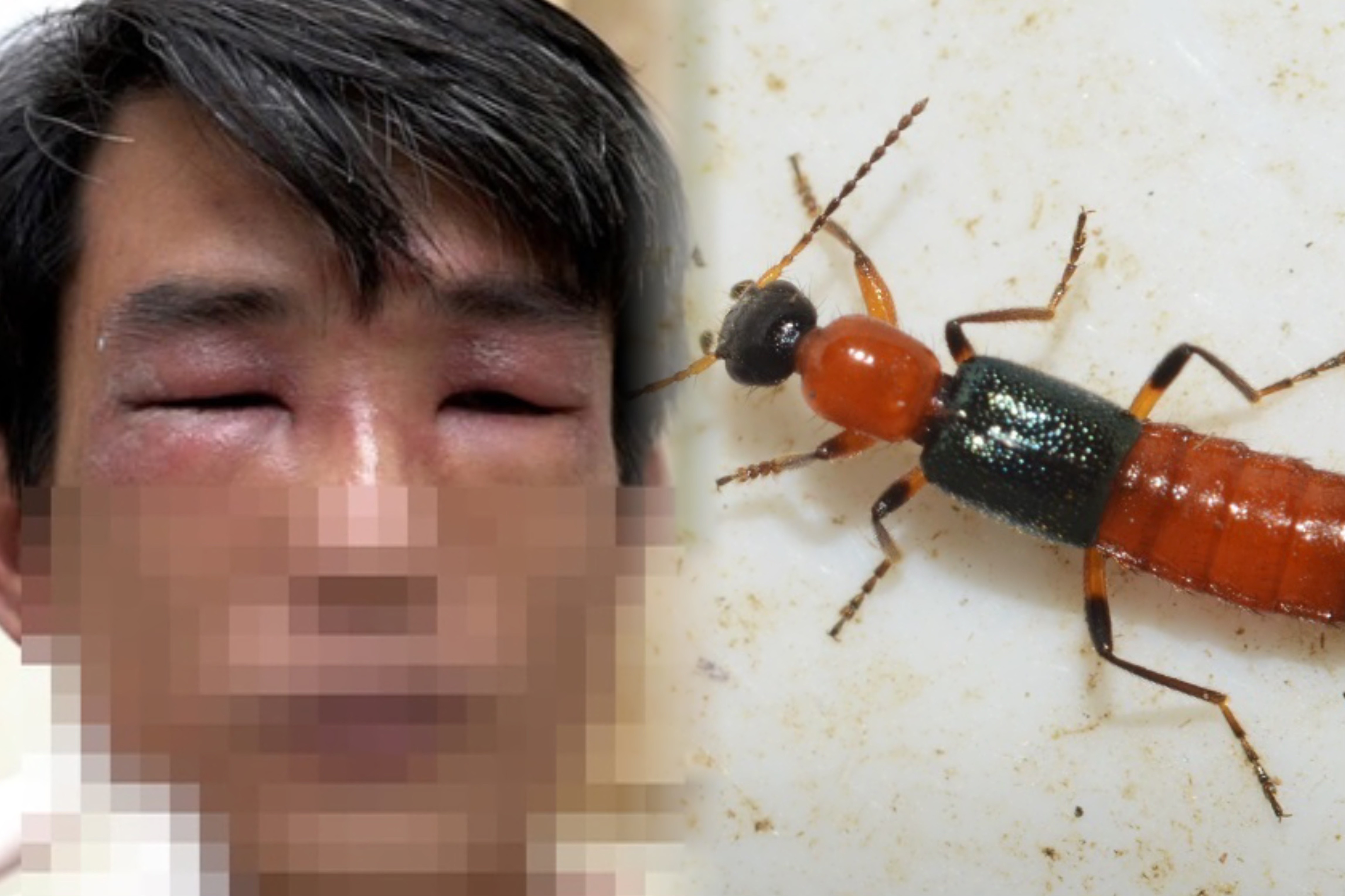 Con vat be bang hat thoc co doc to manh gap 15 lan noc ran ho mang hinh anh