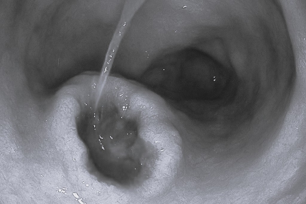 Da day loet nang vi thoi quen pho bien cua nguoi Viet khi dau hinh anh