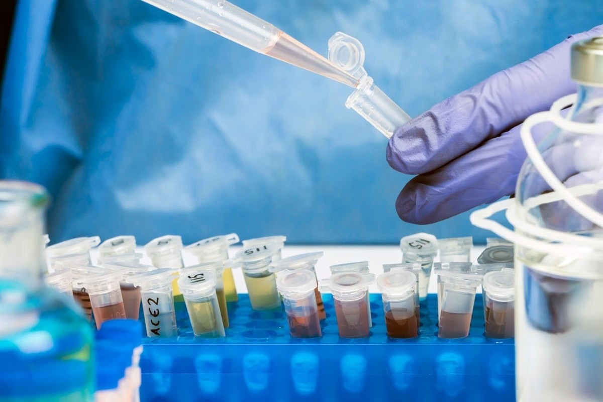 Loai virus hoang dai tro lai Chau Au sau hang chuc nam, WHO canh bao hinh anh