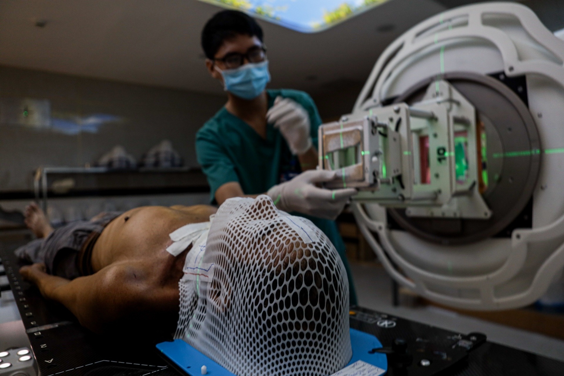 ung thu tuyen giap anh 3