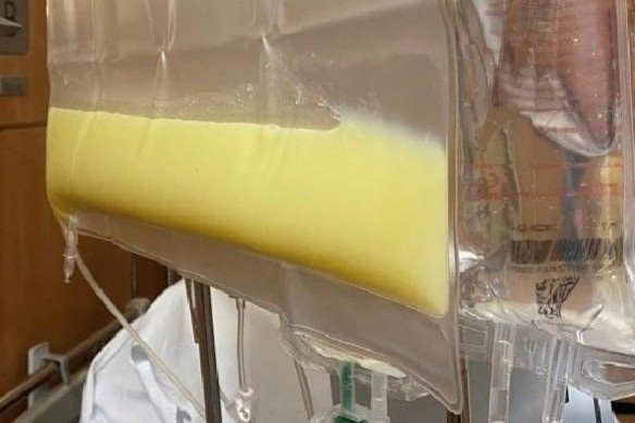 Huyet tuong trang nhu sua vi thoi quen dan ong Viet thuong lam hinh anh