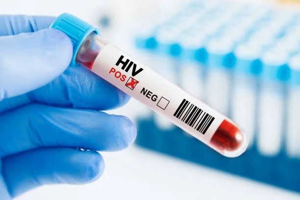 HIV anh 4