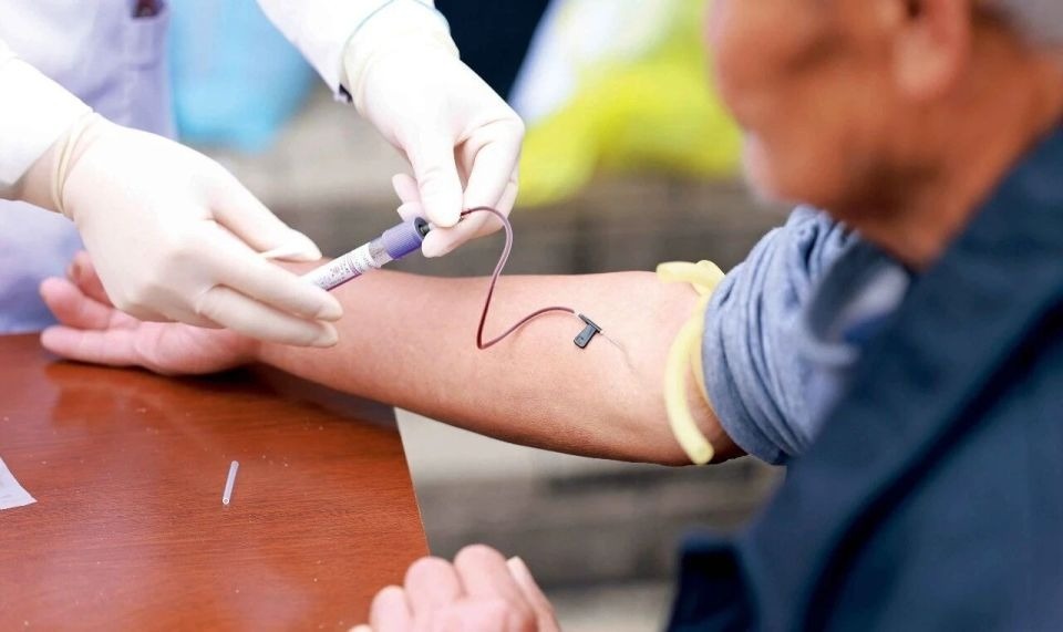 HIV ảnh 2 HIV anh 2