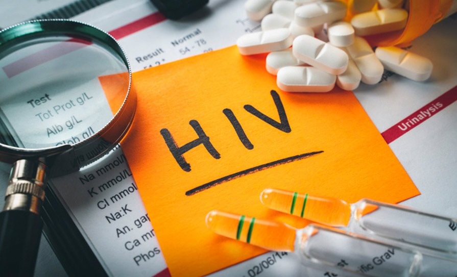 HIV ảnh 3 HIV anh 3