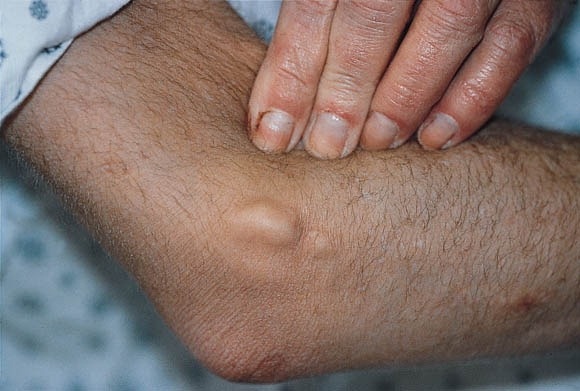 Nguoi dan ong co dau hieu suy than nhieu nam nhung khong biet hinh anh