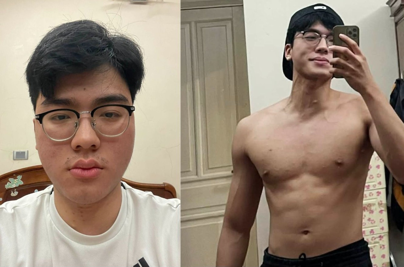 Dien mao khac la cua nam nguoi mau sau 2 nam mac benh than hinh anh