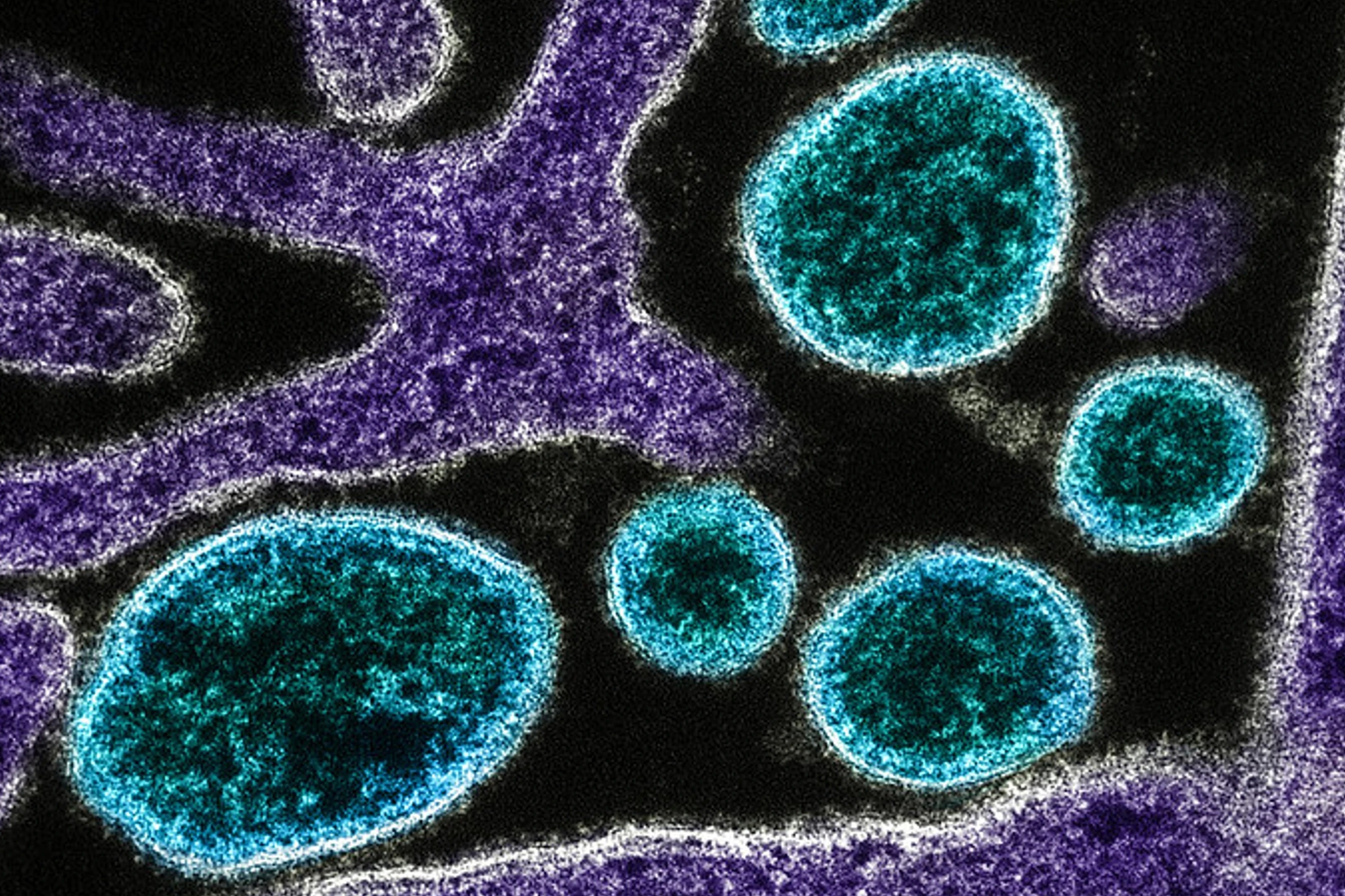 virus Nipah ảnh 3 virus Nipah anh 3