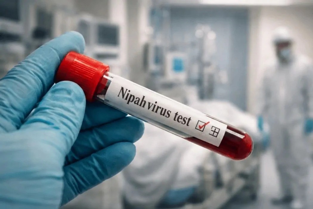 virus Nipah anh 3