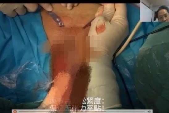 Benh vien Trung Quoc gay phan no vi livestream lo vung kin benh nhan hinh anh