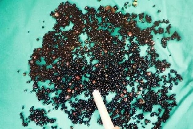 Thoi quen an uong xau kho bo khien tui mat chua gan 5.000 vien soi hinh anh