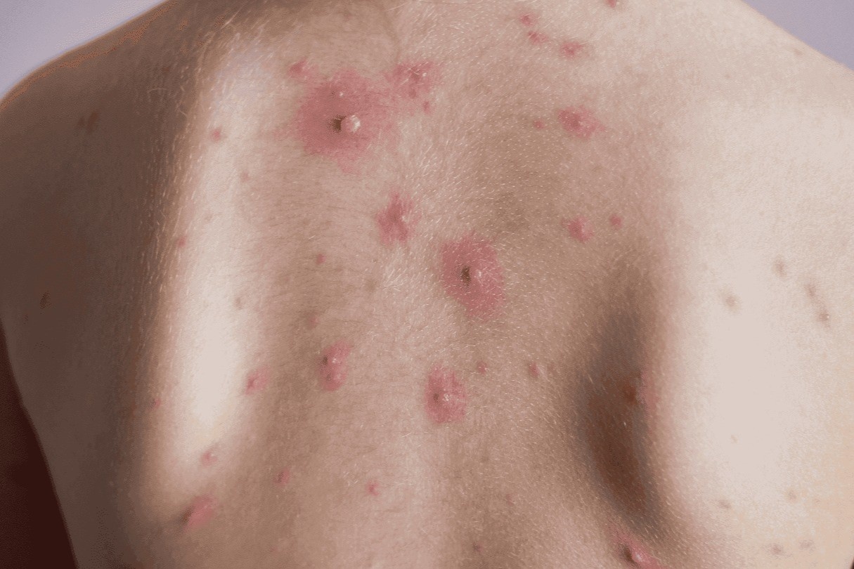 Xuat hien o dich, truong dai hoc Thai Lan chuyen sang hoc online hinh anh