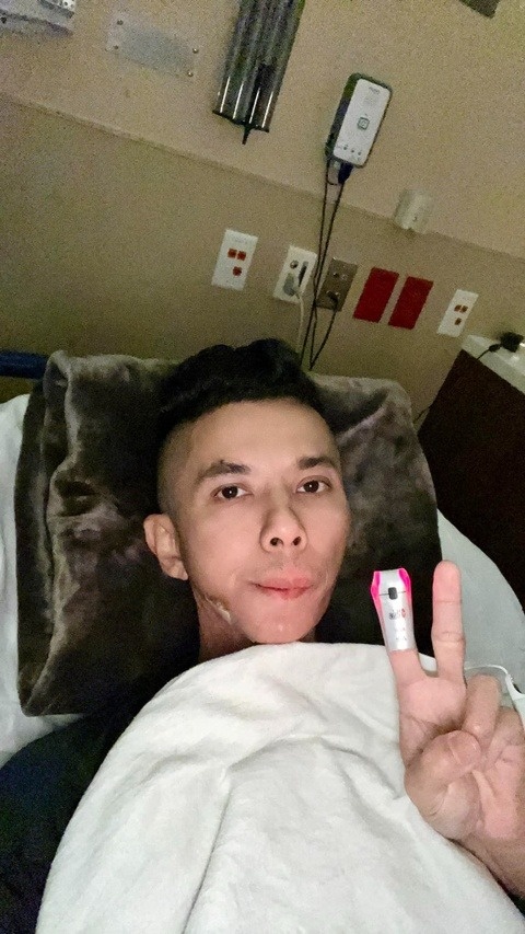 viem khop thai duong anh 2