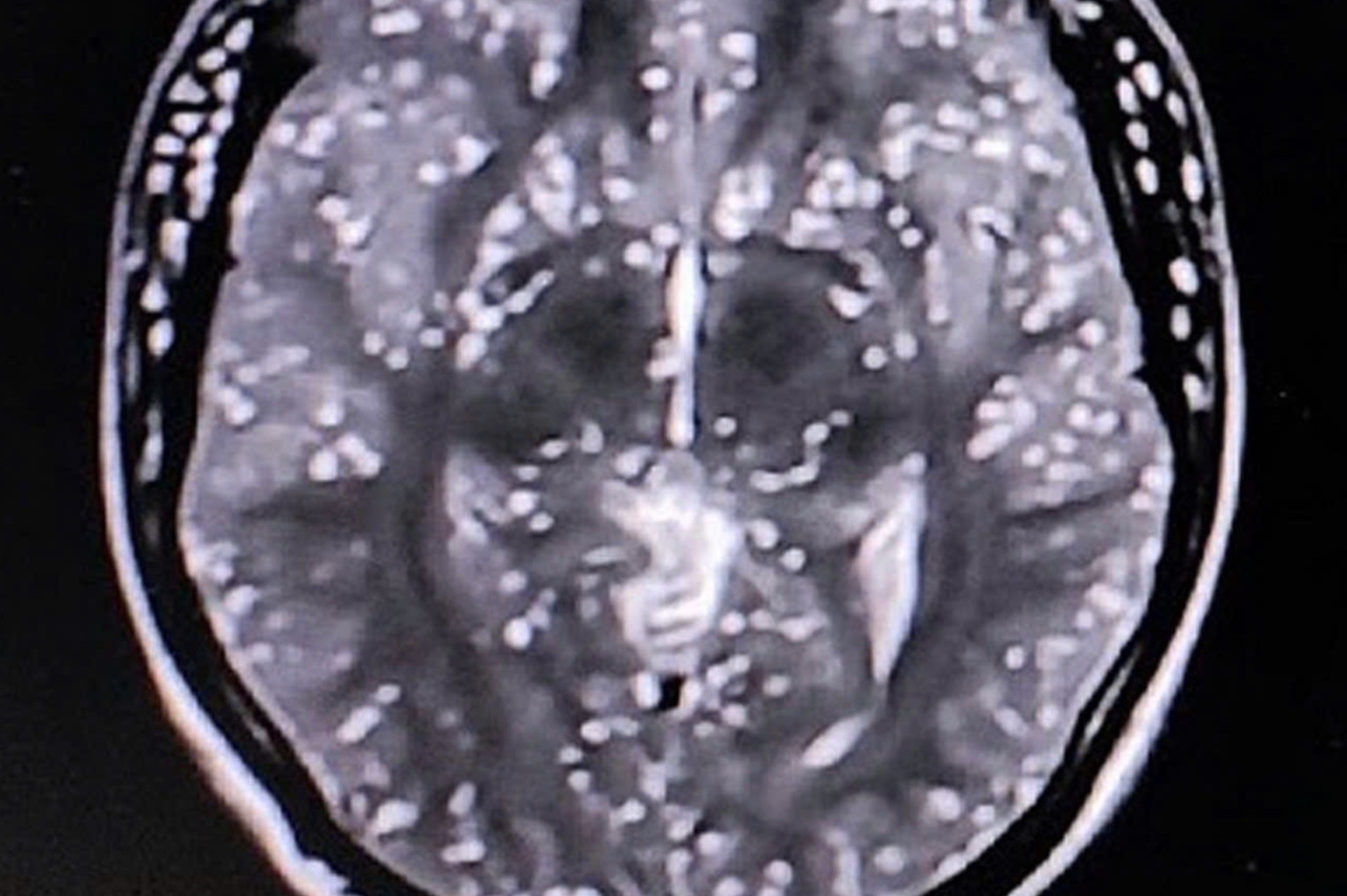 Mon khoai khau khien san lam to trong nao nguoi dan ong hinh anh