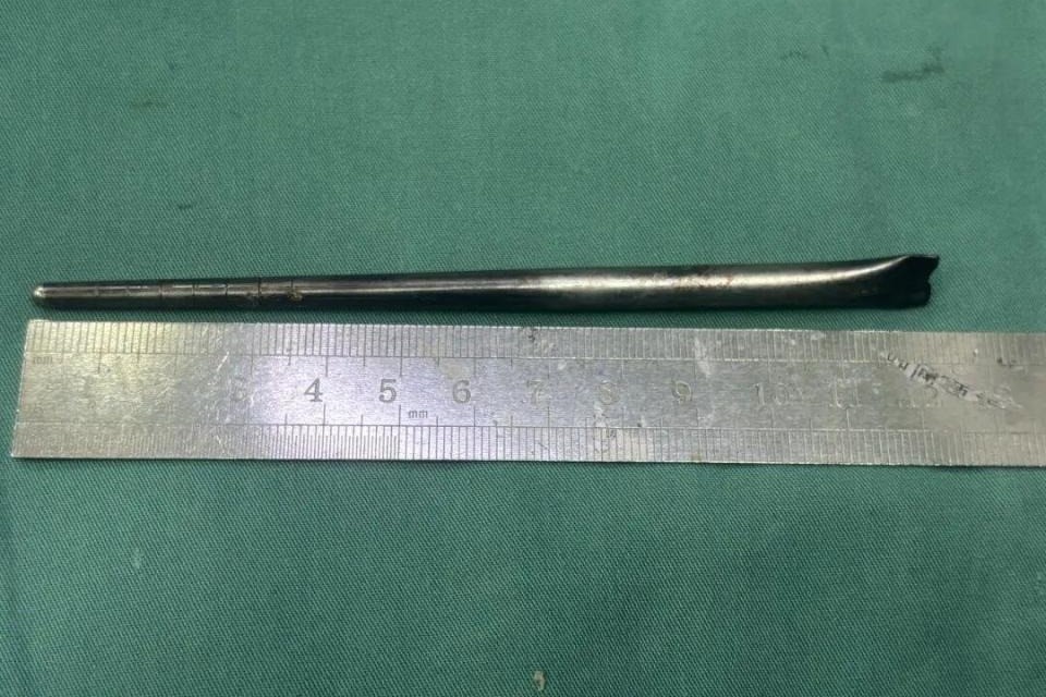 dua ket trong hong anh 1