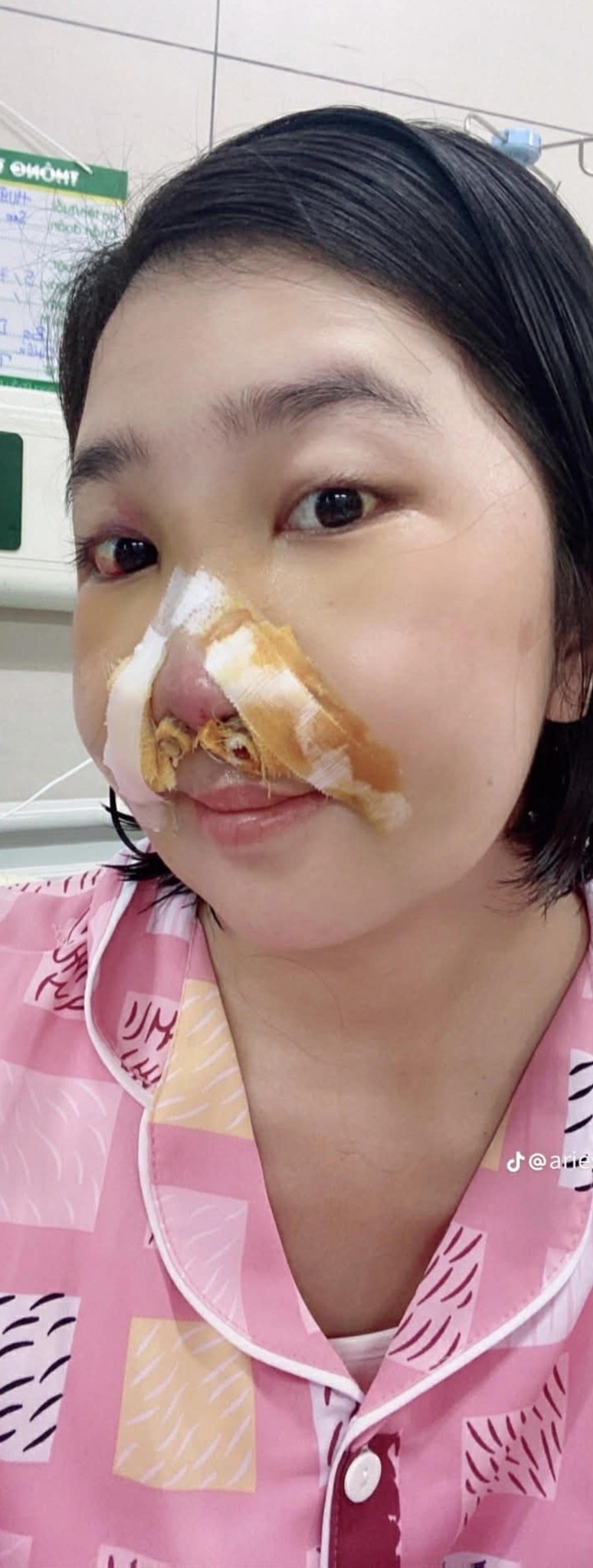 ho moi - ham ech anh 4