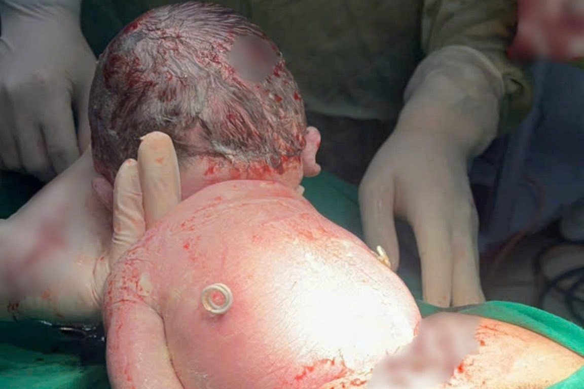 Em be chao doi voi 'doi canh' tren lung hinh anh