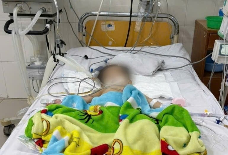 Be trai soc nhiem khuan, suy than cap sau khi uong sua hop pha san hinh anh