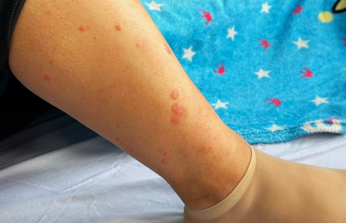 'Tu huy' gan vi me do an song va khong tay giun hinh anh