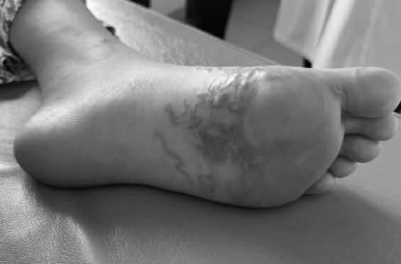 Ca nhiem giun luon nhap vien khien bac si cung ngo ngang hinh anh