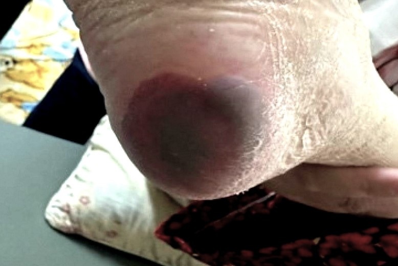 Lam bao benh vi sai lam tai hai sau khi bi manh sanh dam hinh anh